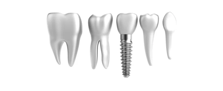 Implant dentaire
